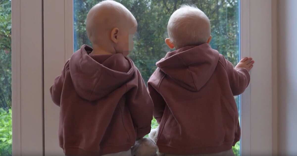 В Австралии родились редчайшие полуидентичные близнецы