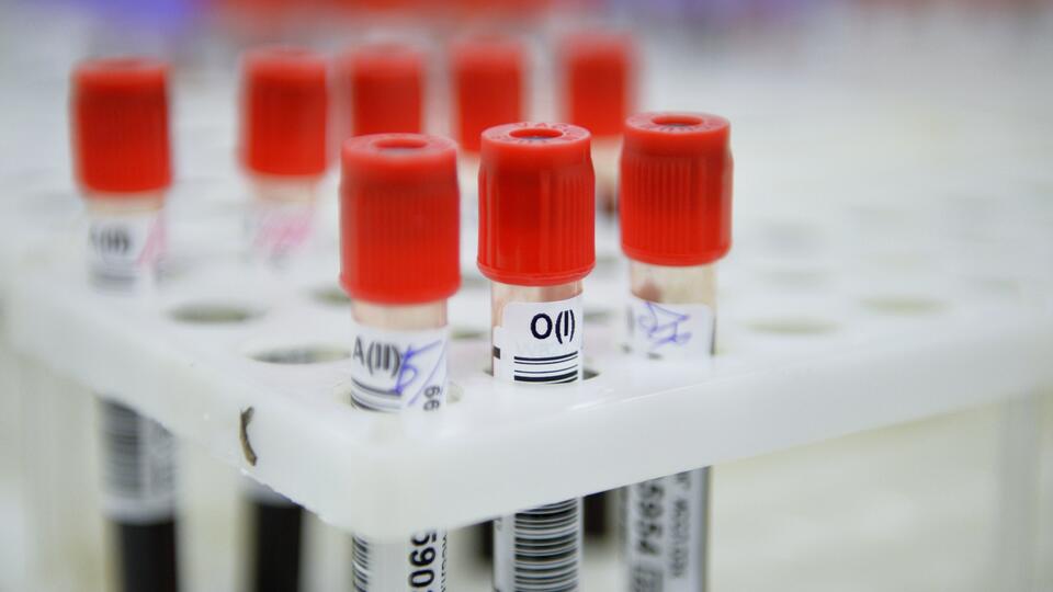 Ученые из трех стран связали смертность от COVID с группой крови
