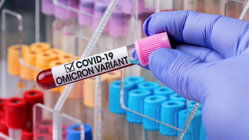 Ученый заявил, что штамм в российских вакцинах от COVID легко заменить