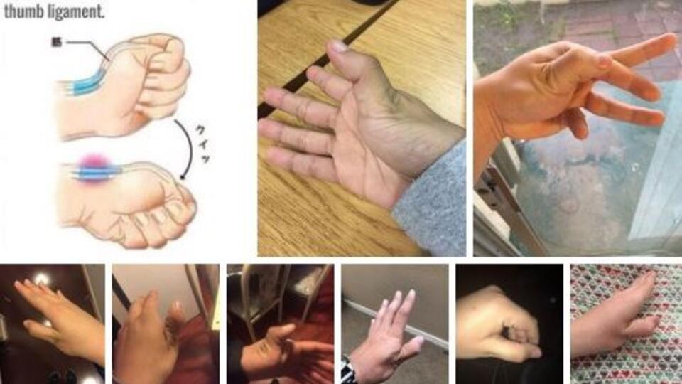 Как тейпировать пальцы
