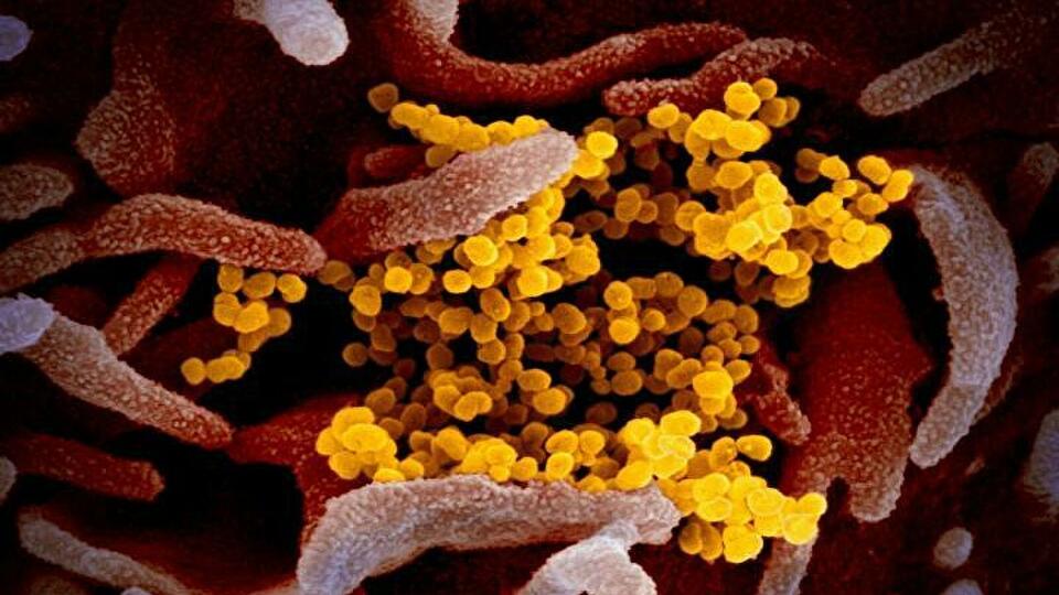 Ученые выявили блокирующее коронавирус средство