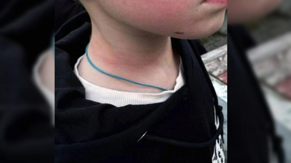 Женщина избила 8-летнего мальчика на детской площадке в Мытищах. Фото: © РЕН ТВ