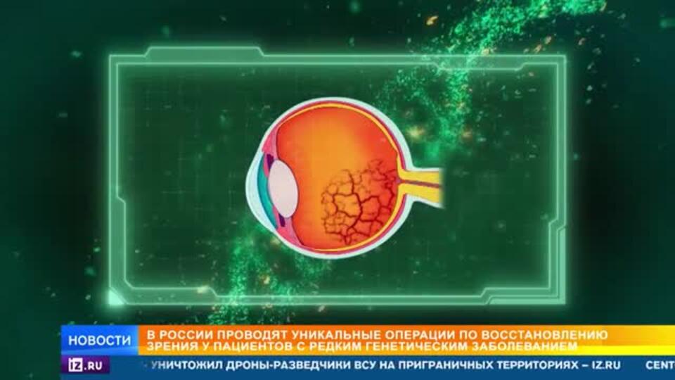 В России проводят уникальные операции по восстановлению зрения